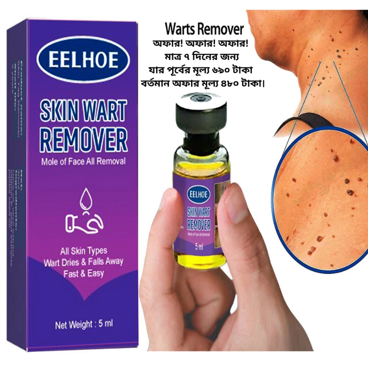 Skin Wart Remover (মাত্র ৭ দিনের জন্য যার পূর্বের মূল্য ৬৯০ টাকা বর্তমান অফার মূল্য ৪৮০ টাকা)