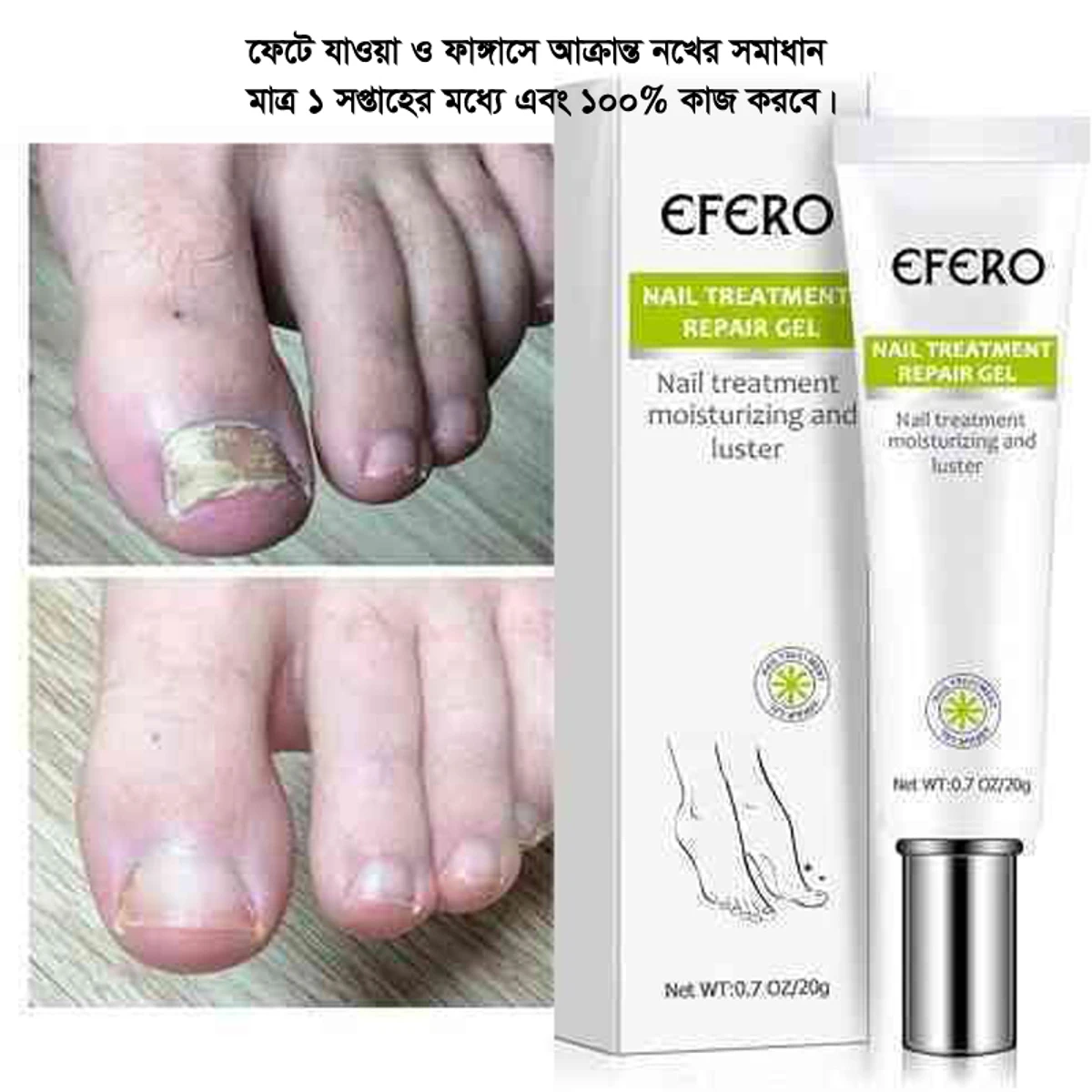 Nail Treatment Repair Gel ( মাত্র এক সপ্তাহের মধ্যে সমাধান এবং ১০০% কাজ করবে )