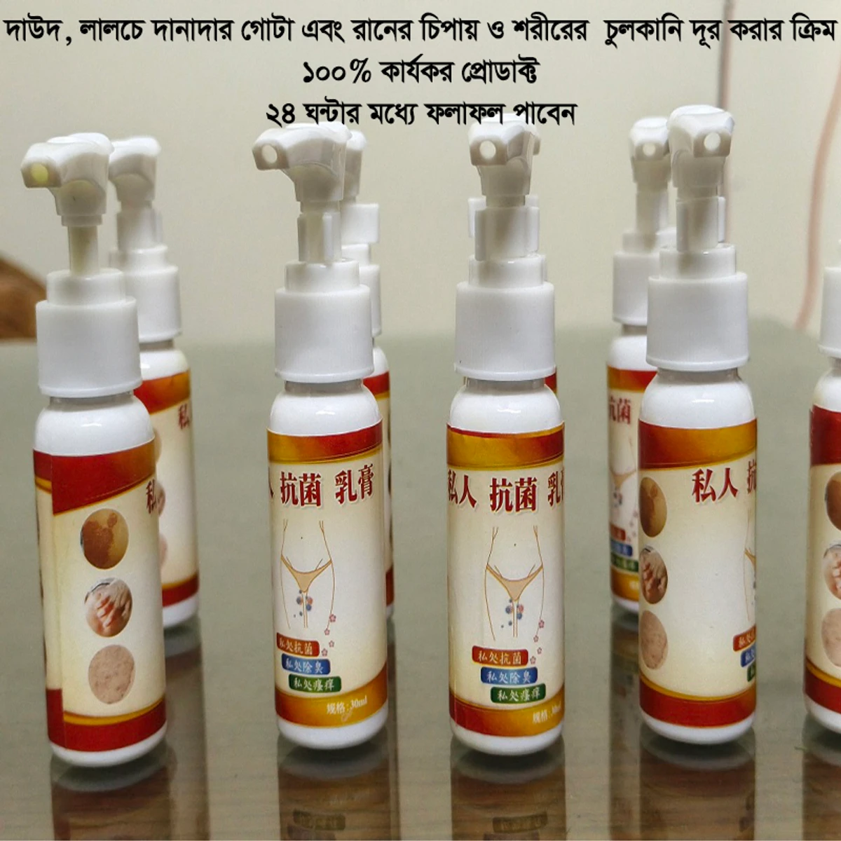 Antibacterial Cream (১০০% কার্যকর প্রডাক্ট)-ফুল কোর্স