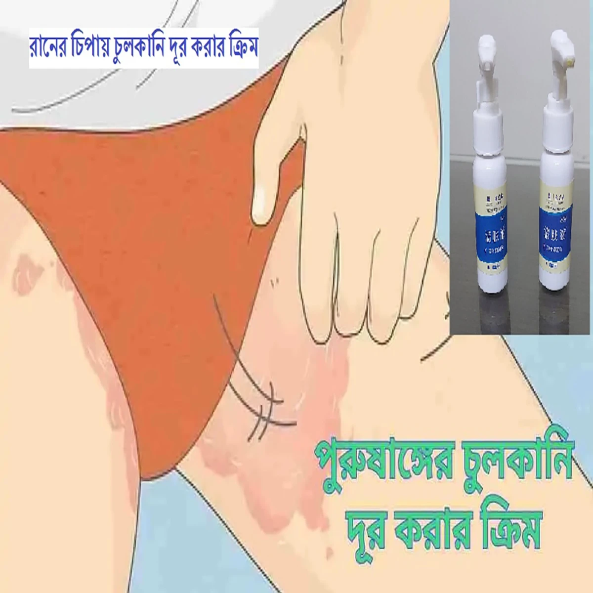 Antibacterial Cream 1pc -১০০% কার্যকর প্রডাক্ট